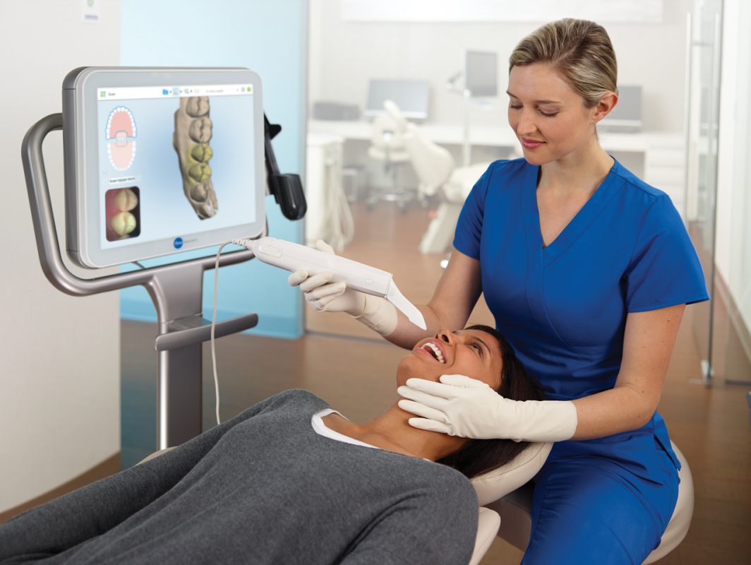 Invisalign Aligners